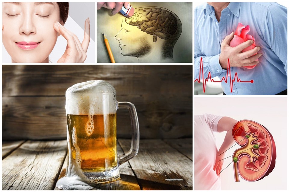 Bia có nhiều công dụng nếu biết uống đúng cách Bia có nhiều công dụng nếu biết uống đúng cách